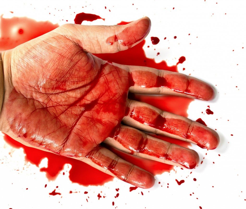 Top 10 Craziest Beauty Treatments 4 Blood Therapy