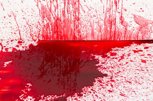 A Bloody Botched Execution