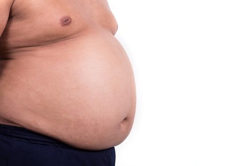 10 Terrible Ways Fat People Are Discriminated Against