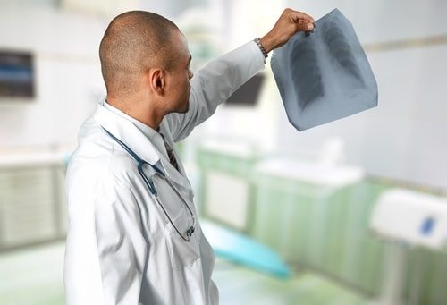 10 Accidental Inventions We Can’t Live Without 2 X-rays an Accidental Invention but indispensible