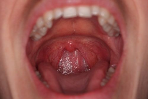 You snore because of you're long uvula. "Oh come on. It's average."