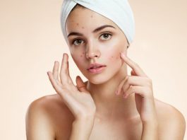 how-to-get-rid-of-acne-in-10-simple-steps