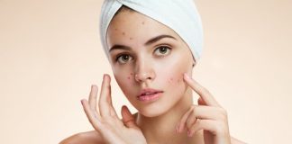 how-to-get-rid-of-acne-in-10-simple-steps
