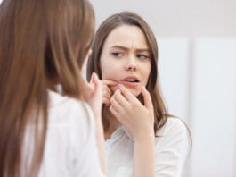Acne in Your 20s