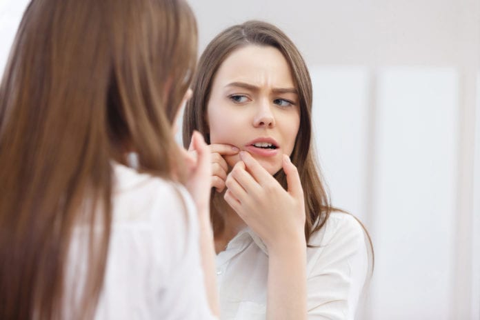 Acne in Your 20s