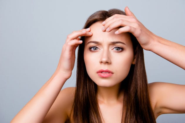 10 Reasons You Are Breaking Out In Acne On Your Forehead