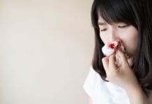 10 Steps You Can Take to Stop a Nosebleed